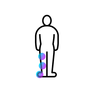 Icon segmentale Dystonie